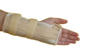 فیزیوتراپی مچ دست در منزل