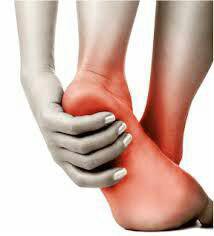 درمان خار پاشنه پا