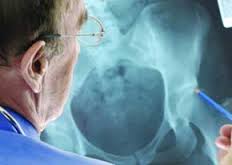 فیزیوتراپی شکستگی