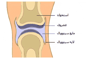 روماتیسم مفصلی
