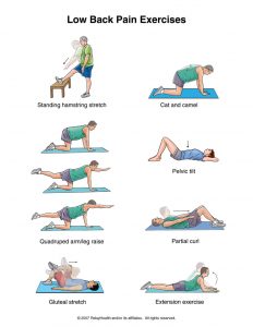 ورزش سیاتیک