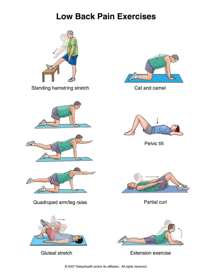 ورزش سیاتیک