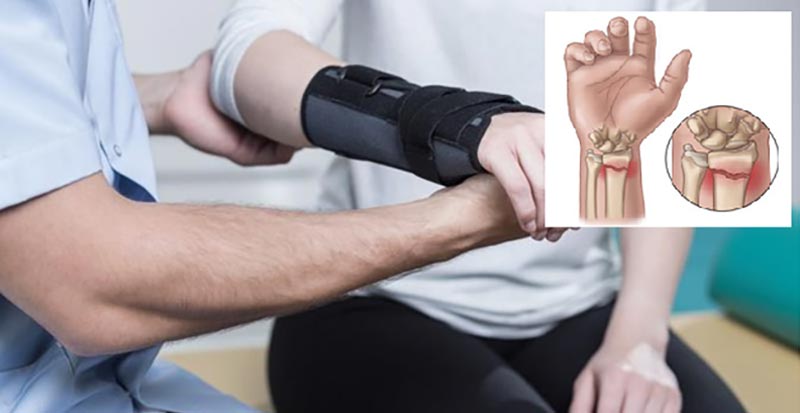 درمان پوکی استخوان با فیزیوتراپی