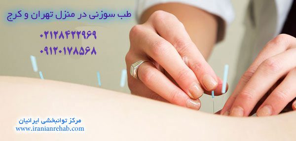 طب سوزنی در منزل تهران و کرج