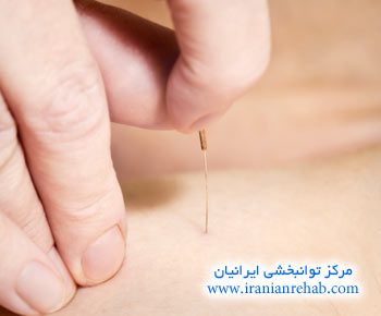 طب سوزنی چیست؟