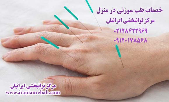 طب سوزنی در منزل