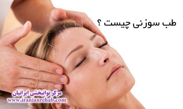 طب سوزنی چیست