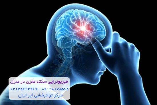 سکته مغزی