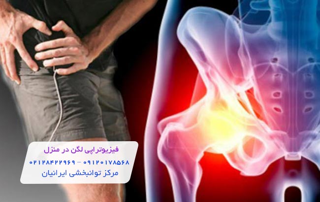 فیزیوتراپی لگن