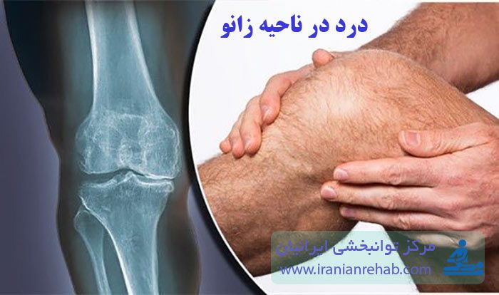 درد در ناحیه زانو