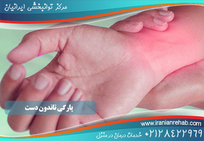 پارگی تاندون دست