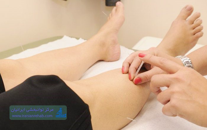 طب سوزنی بیمار فلج مغزی در منزل