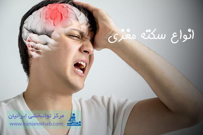 انواع سکته مغزی