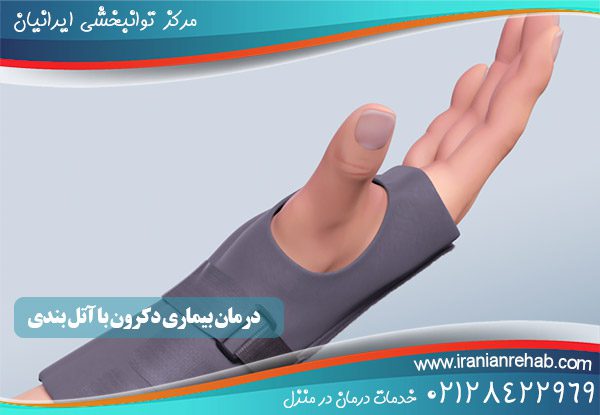 درمان بیماری دکرون با آتل بندی