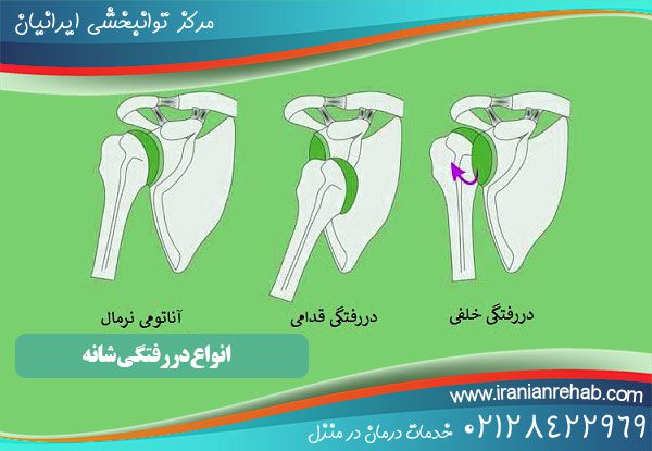 انواع دررفتگی شانه