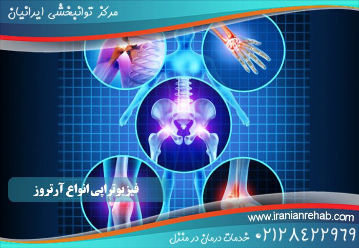 فیزیوتراپی آرتروز