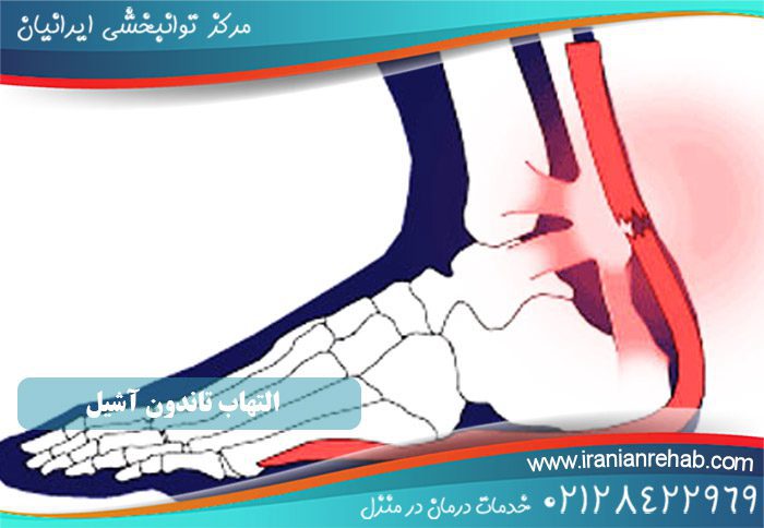 التهاب تاندون آشیل