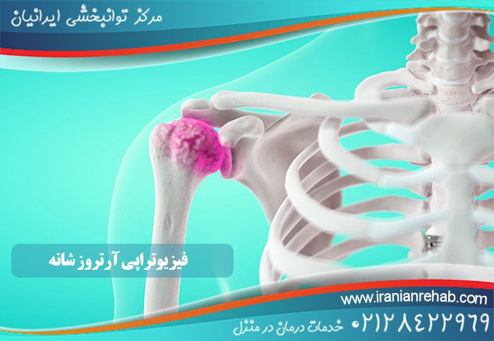 فیزیوتراپی آرتروز شانه
