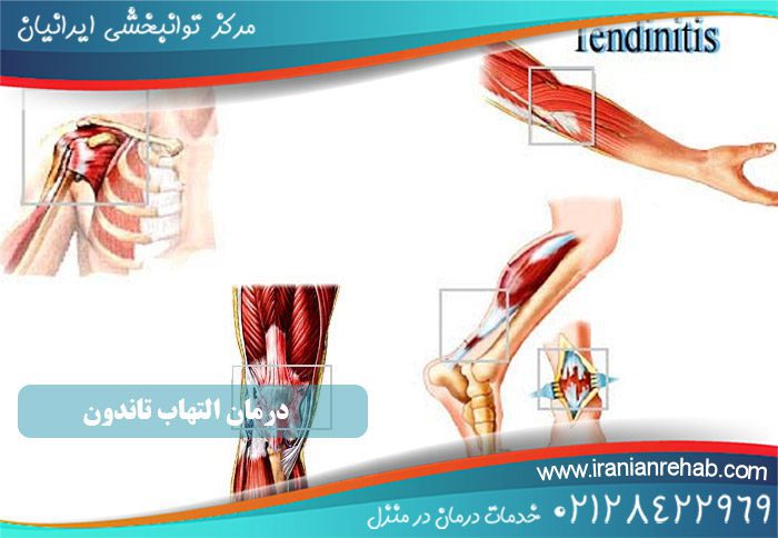 درمان التهاب تاندون