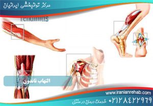 انواع التهاب تاندون