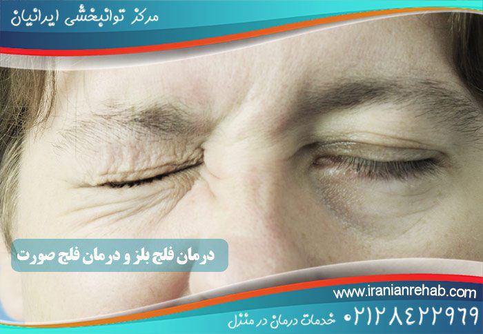 درمان فلج بلز و درمان فلج صورت