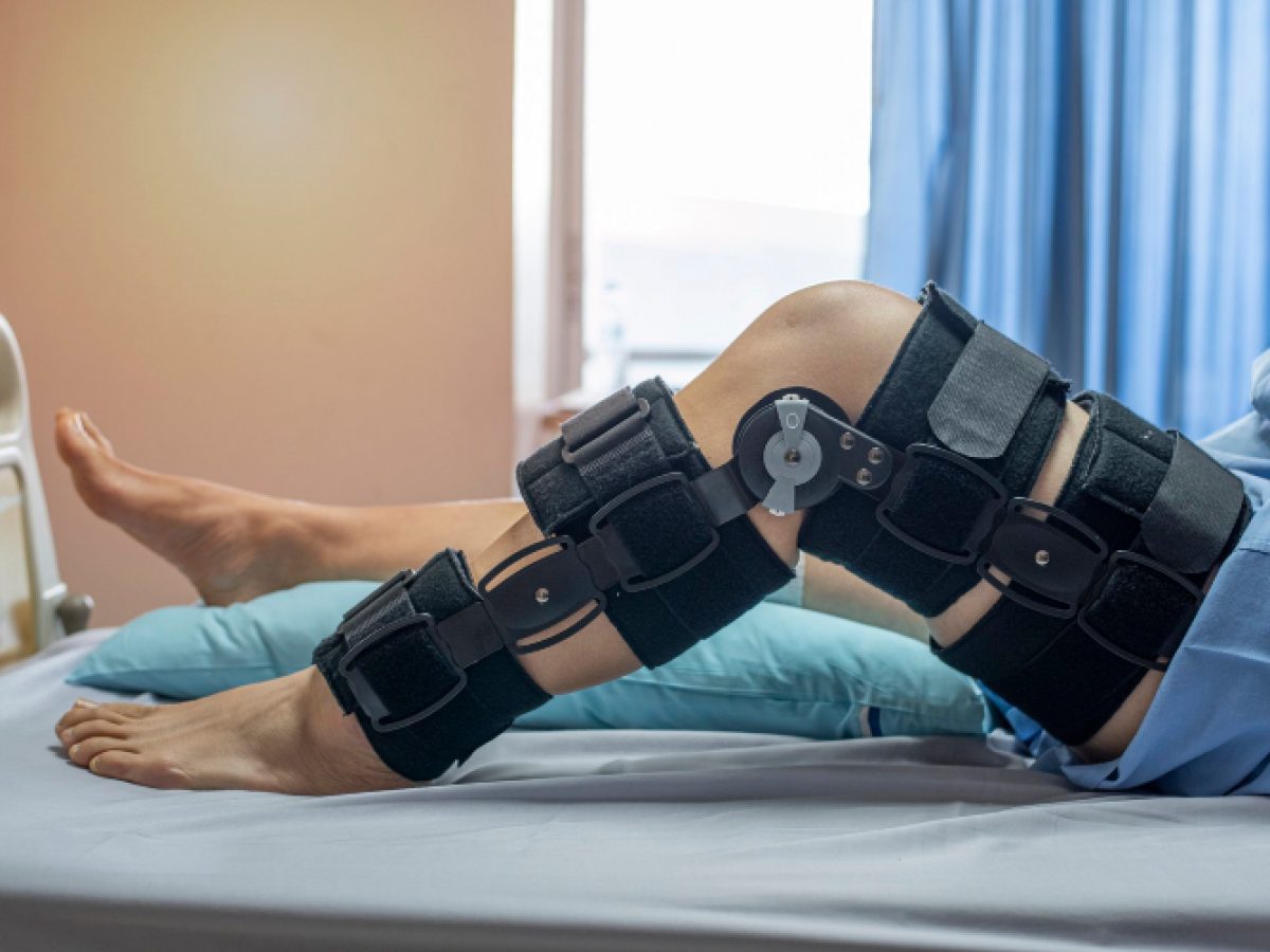 درمان زانو پرانتزی با فیزیوتراپی