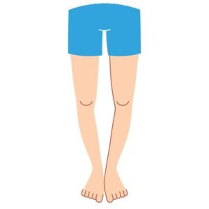 علت پرانتزی شدن پا در بزرگسالی