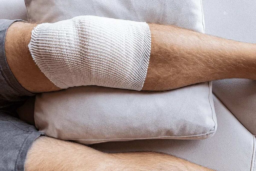 مراقبت های بعد از عمل تعویض مفصل زانو