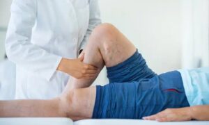 آب آوردن زانو