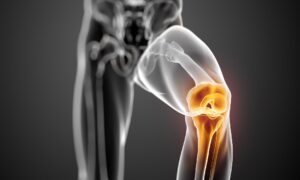 مینیسک زانو 