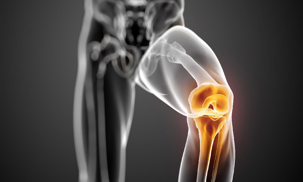 مینیسک زانو