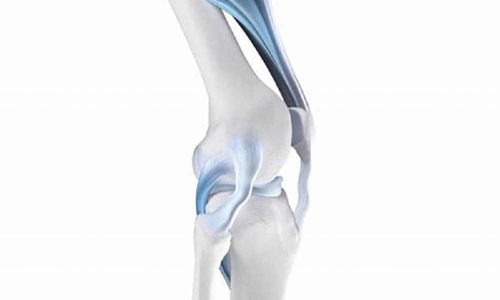 زانوی ناپایدار