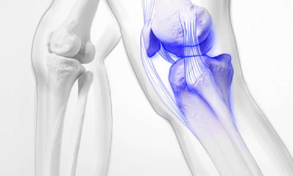 کمبود چه ویتامینی باعث زانو درد می شود