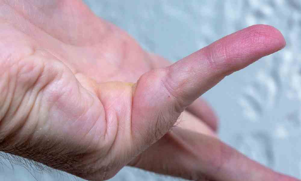 انگشت ماشهای