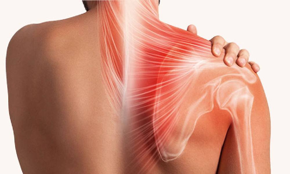 درمان افتادگی شانه با فیزیوتراپی