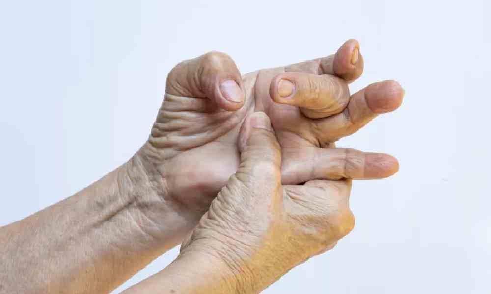 انگشت ماشهای