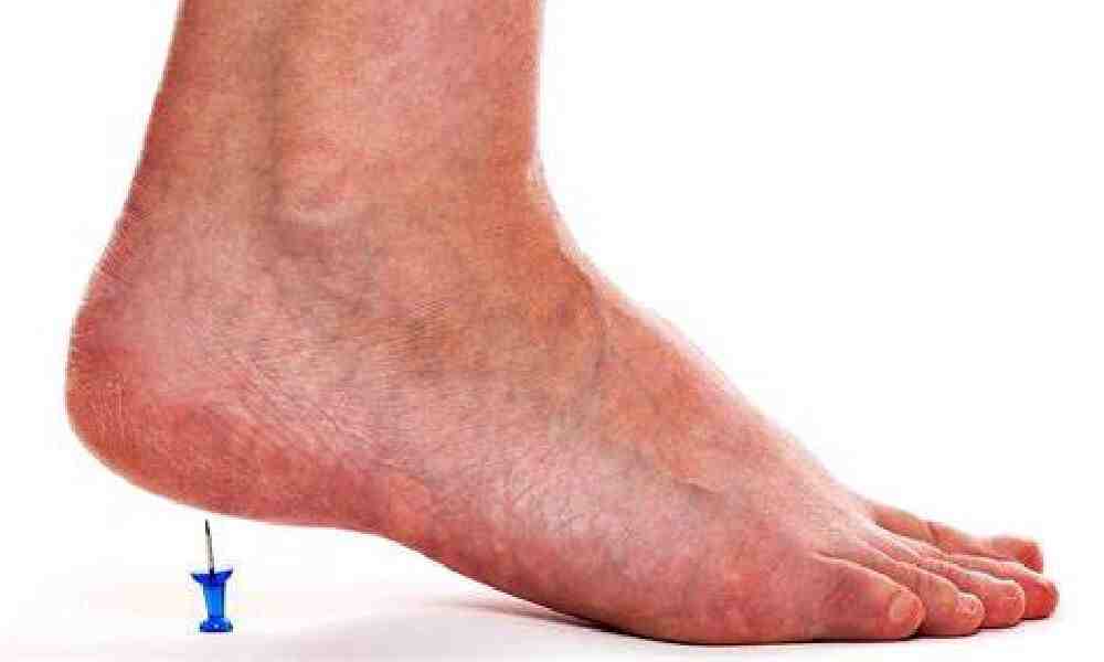 درمان خارپاشنه با فیزیوتراپی