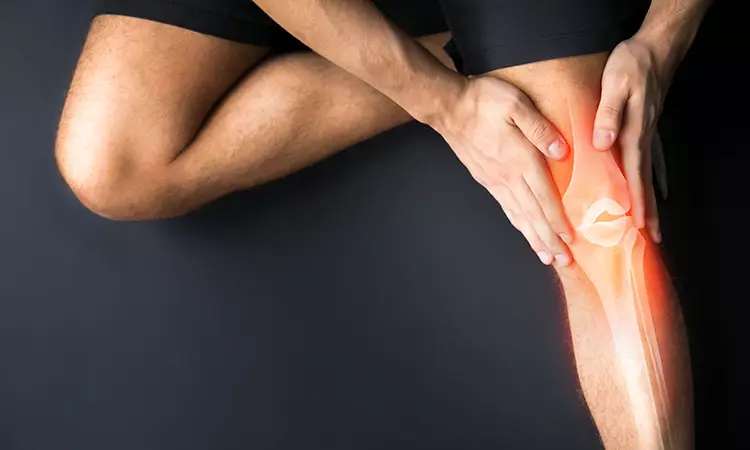 چگونه از آرتروز زانو جلوگیری کنیم؟