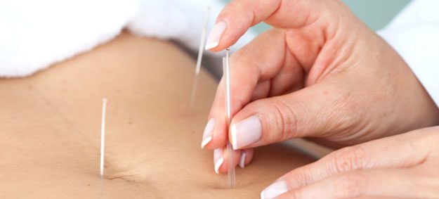 طب سوزنی لاغری