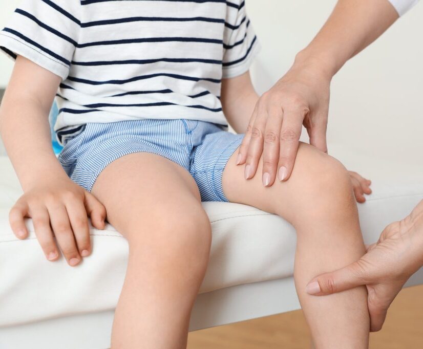 آرتروز زانو در کودکان