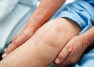 فیزیوتراپی در منزل با بیمه و مزایای آن